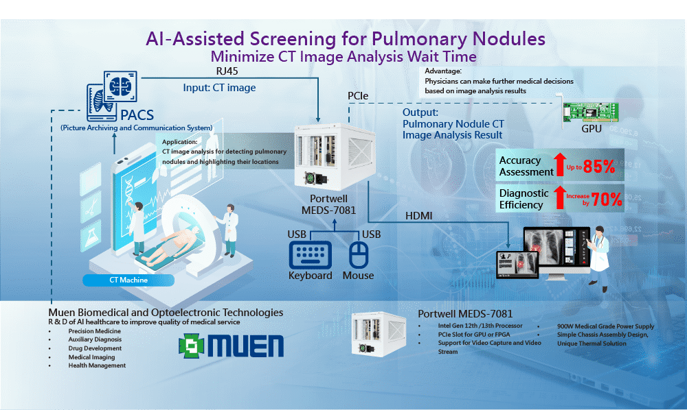 AI-Assisted Screening for Pulmonary Nodules